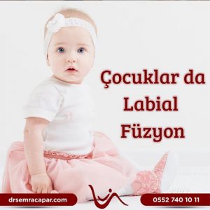 Çocuklarda Labial Füzyon